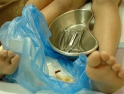 Mitos dan Fakta Sunat Perempuan: Risiko dan Kesehatan